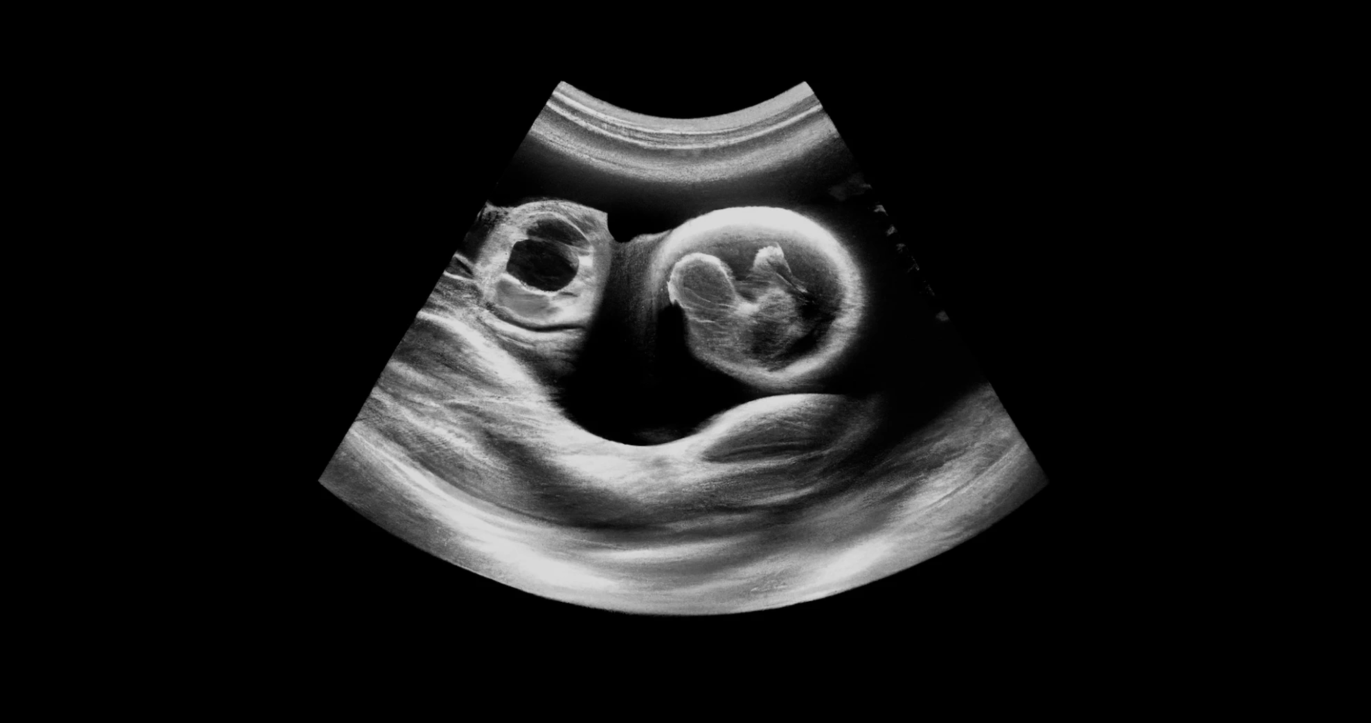 Kurzfilmnacht Luzern 2025 hero banner image placeholder